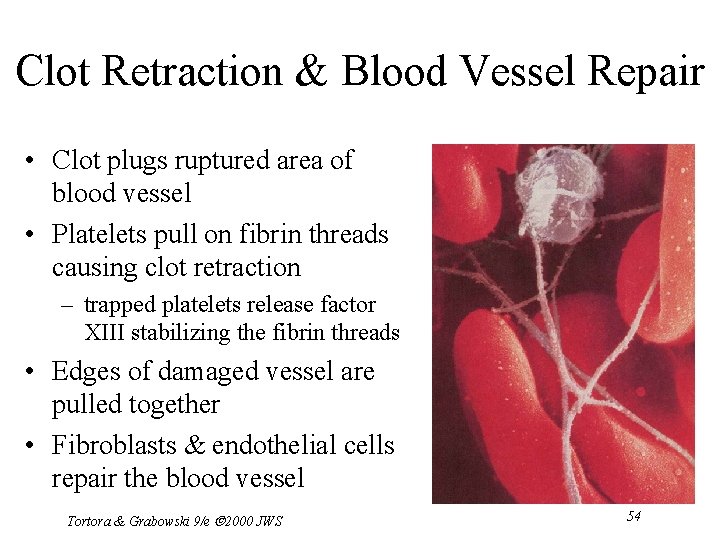 Clot Retraction & Blood Vessel Repair • Clot plugs ruptured area of blood vessel
