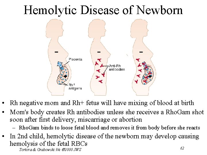 Hemolytic Disease of Newborn • Rh negative mom and Rh+ fetus will have mixing