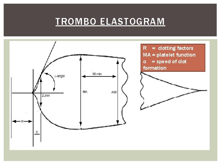 TROMBO ELASTOGRAM R = clotting factors MA = platelet function α = speed of