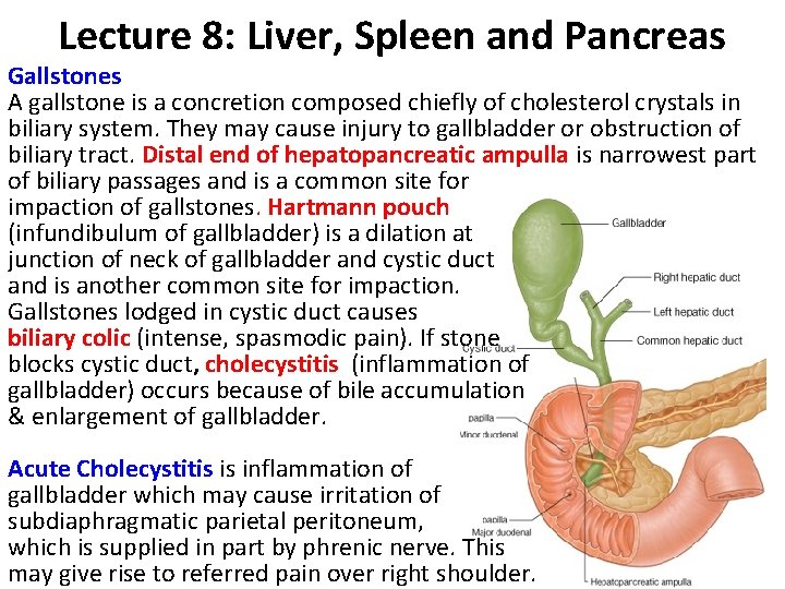 Lecture 8: Liver, Spleen and Pancreas Gallstones A gallstone is a concretion composed chiefly