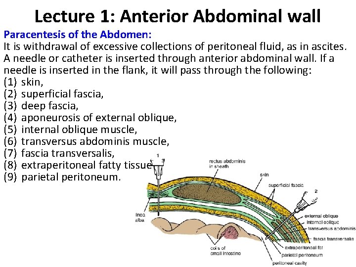 Lecture 1: Anterior Abdominal wall Paracentesis of the Abdomen: It is withdrawal of excessive