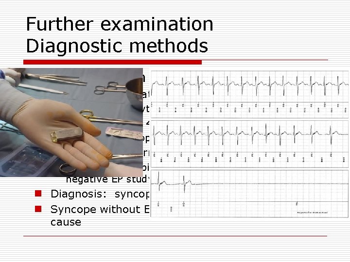 Further examination Diagnostic methods o ECG monitoration n During hospiralization o Suspected arrhythmic cause,