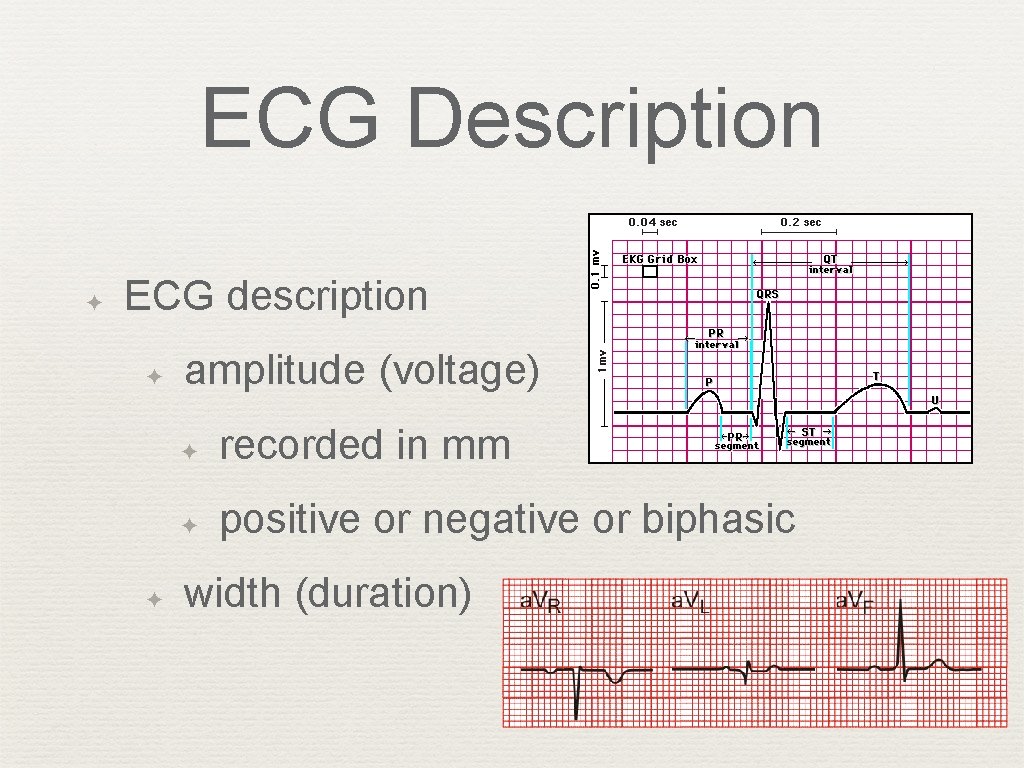 ECG Description ✦ ECG description ✦ ✦ amplitude (voltage) ✦ recorded in mm ✦