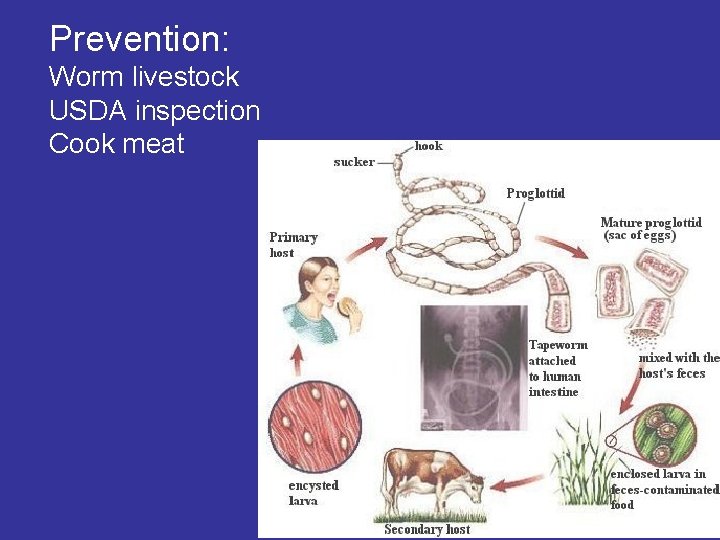 Prevention: Worm livestock USDA inspection Cook meat Prevention: Worm livestock USDA inspection Cook meat