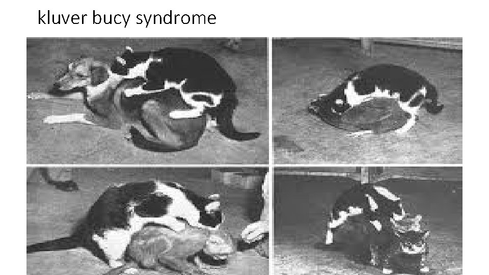 kluver bucy syndrome kluver bucy syndrome