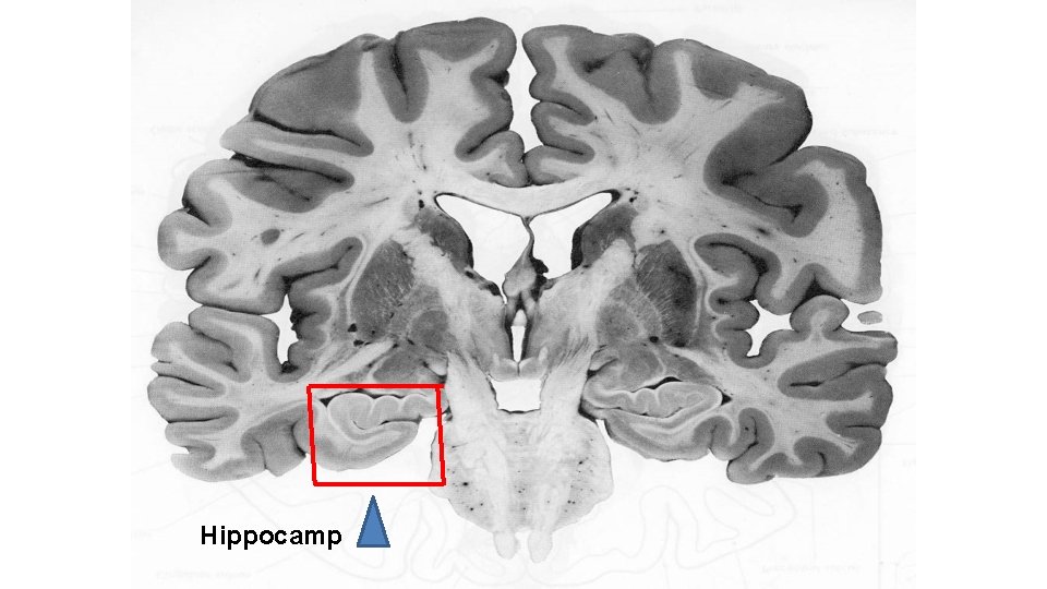 Hippocamp Hippocamp