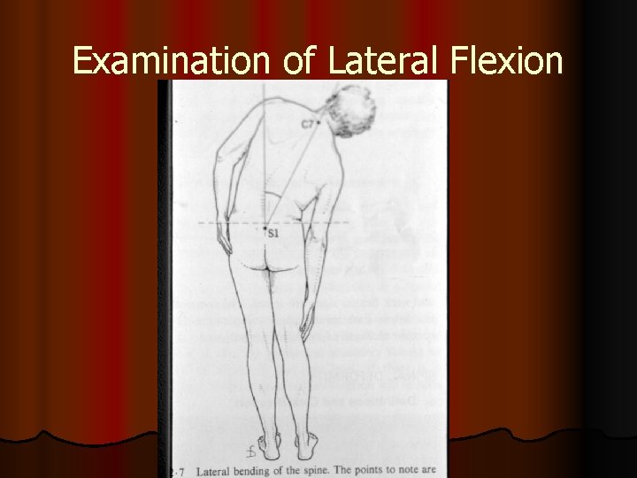 Examination of Lateral Flexion 