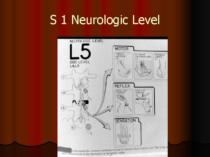 S 1 Neurologic Level 