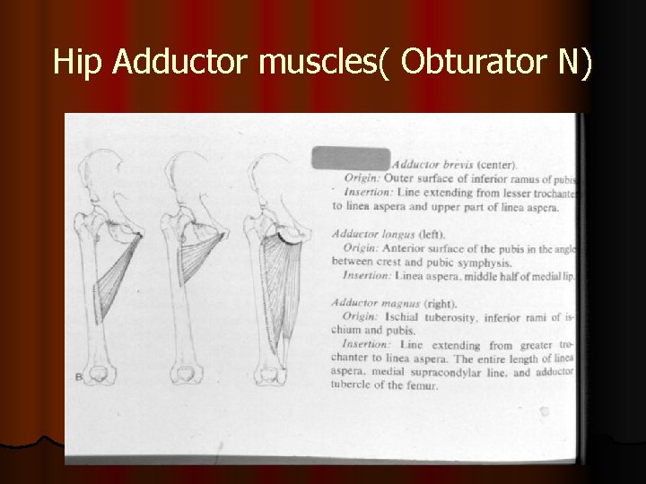 Hip Adductor muscles( Obturator N) 