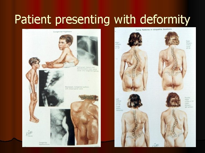 Patient presenting with deformity 