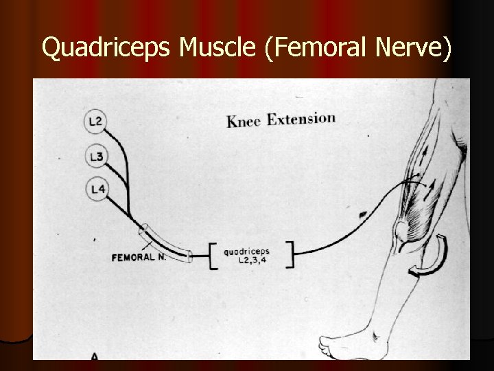 Quadriceps Muscle (Femoral Nerve) 