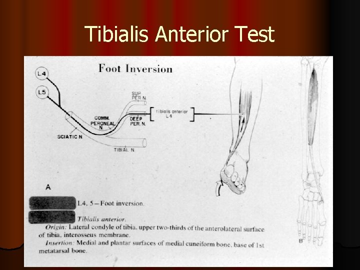 Tibialis Anterior Test 