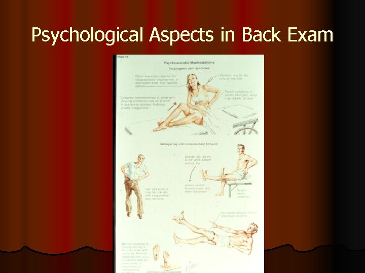 Psychological Aspects in Back Exam 