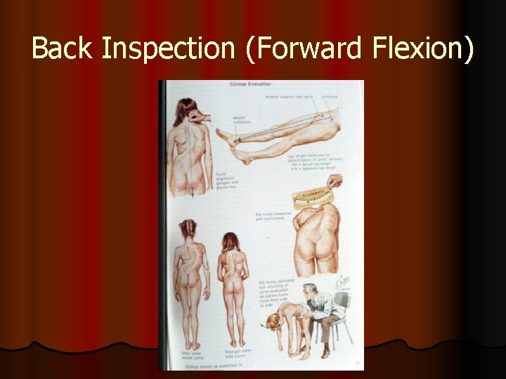 Back Inspection (Forward Flexion) 