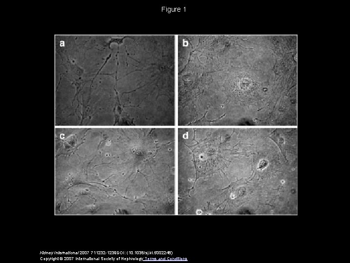 Figure 1 Kidney International 2007 711232 -1239 DOI: (10. 1038/sj. ki. 5002248) Copyright ©