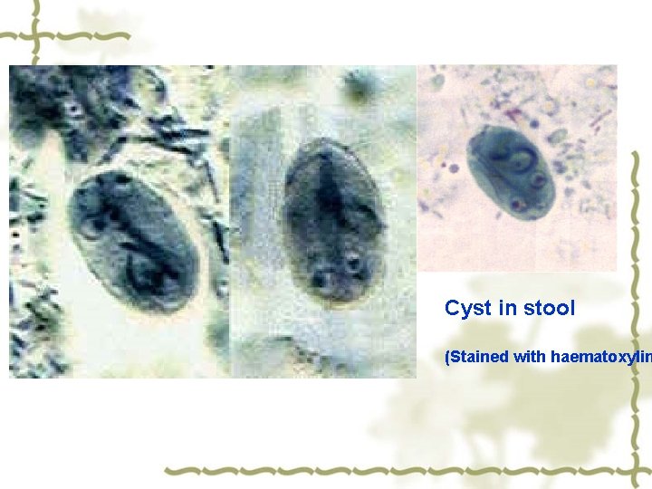 Cyst in stool (Stained with haematoxylin 