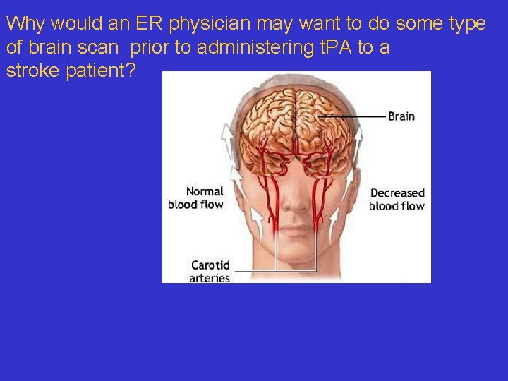 Why would an ER physician may want to do some type of brain scan