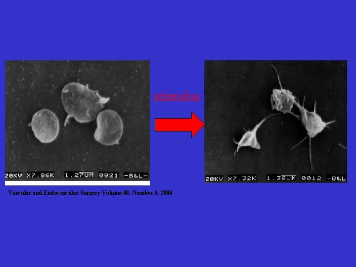 stimulus Vascular and Endovascular Surgery Volume 40, Number 4, 2006 