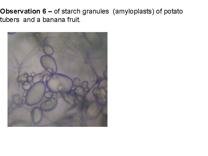 Observation 6 – of starch granules (amyloplasts) of potato tubers and a banana fruit.