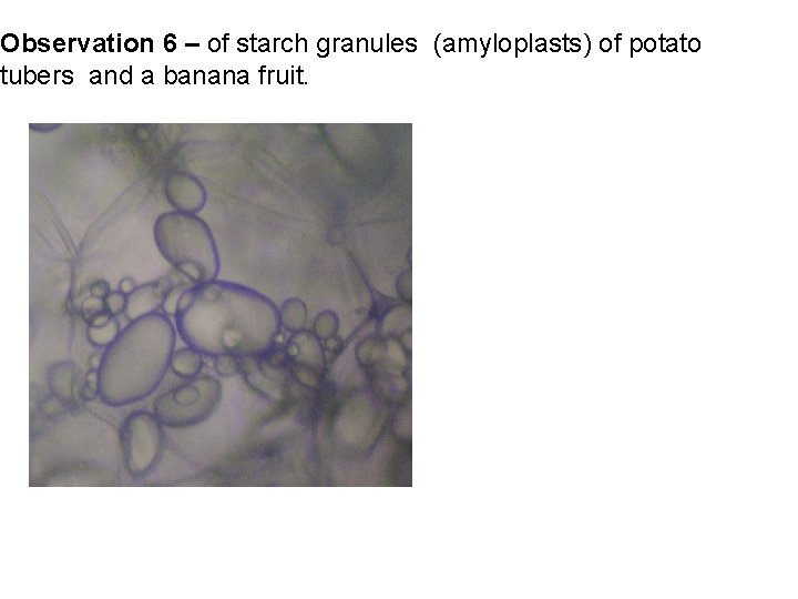 Observation 6 – of starch granules (amyloplasts) of potato tubers and a banana fruit.