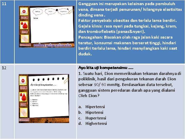 11 Gangguan ini merupakan kelainan pada pembuluh vena, dimana terjadi penurunan/ hilangnya elastisitas dinding