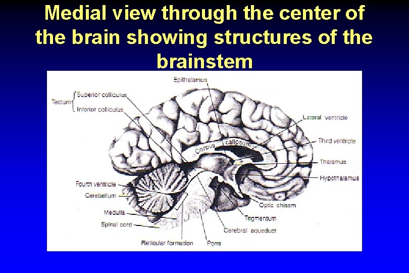 Medial view through the center of the brain showing structures of the brainstem 