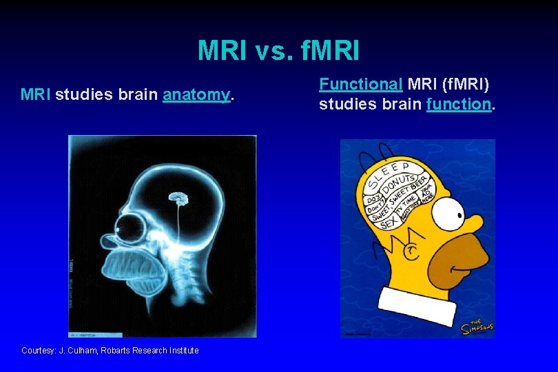 MRI vs. f. MRI studies brain anatomy. Courtesy: J. Culham, Robarts Research Institute Functional