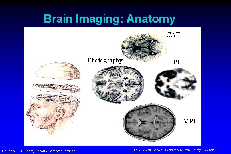 Brain Imaging: Anatomy CAT Photography PET MRI Courtesy: J. Culham, Robarts Research Institute Source:
