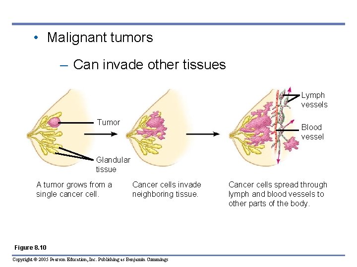  • Malignant tumors – Can invade other tissues Lymph vessels Tumor Blood vessel