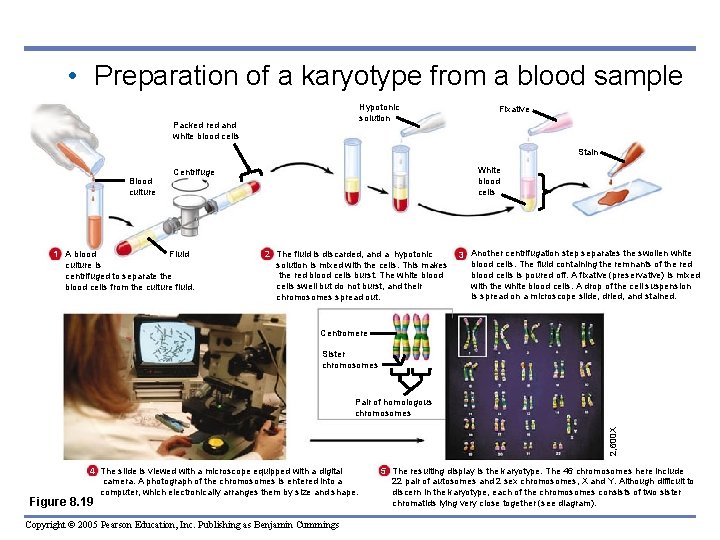  • Preparation of a karyotype from a blood sample Hypotonic solution Packed red