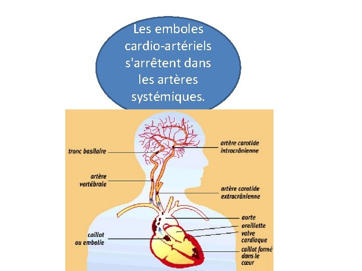 Les emboles cardio-artériels s'arrêtent dans les artères systémiques. 