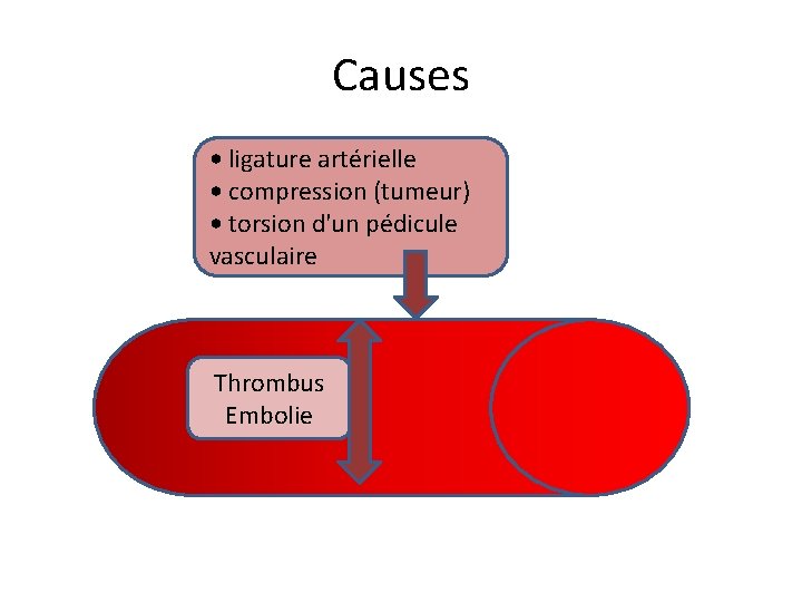 Causes • ligature artérielle • compression (tumeur) • torsion d'un pédicule vasculaire Thrombus Embolie