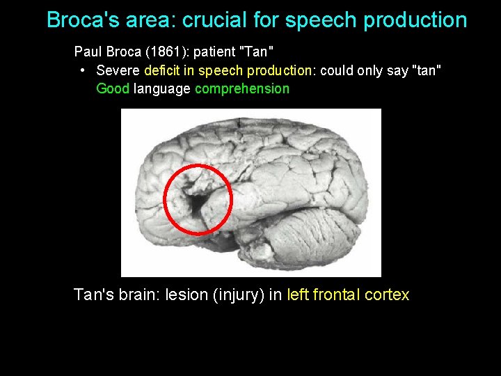 Broca's area: crucial for speech production Paul Broca (1861): patient "Tan" • Severe deficit