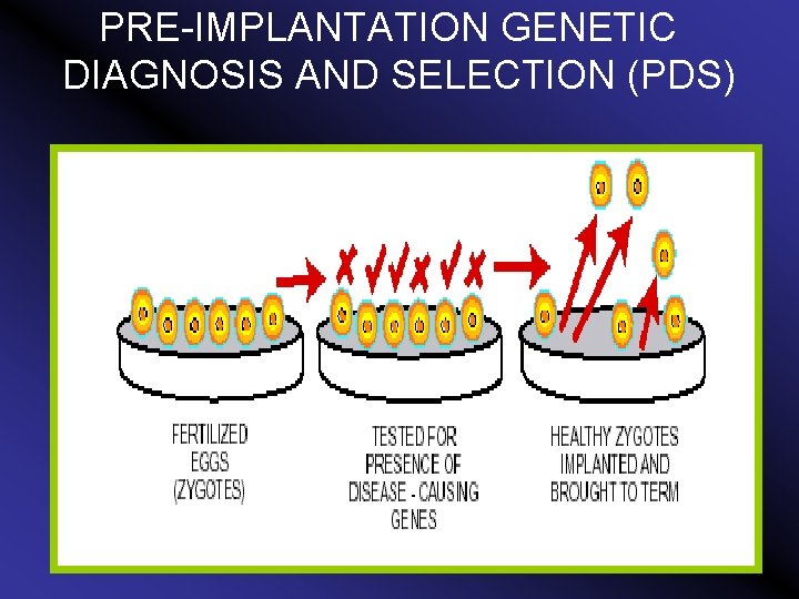 PRE-IMPLANTATION GENETIC DIAGNOSIS AND SELECTION (PDS) 
