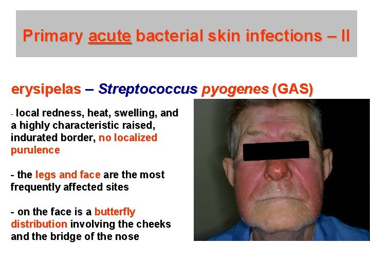 Primary acute bacterial skin infections – II erysipelas – Streptococcus pyogenes (GAS) - local