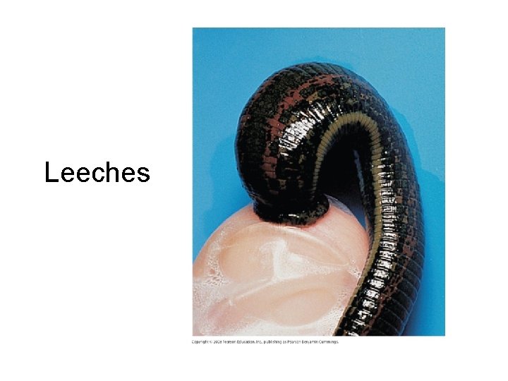 Leeches 