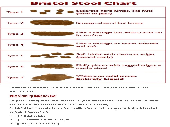  The Bristol Stool Chart was developed by K. W. Heaton and S. J.