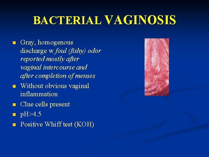 BACTERIAL VAGINOSIS n n n Gray, homogenous discharge w foul (fishy) odor reported mostly