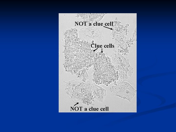 NOT a clue cell Clue cells NOT a clue cell 