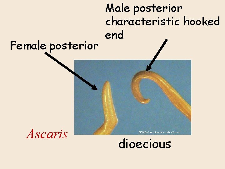 Female posterior Ascaris Male posterior characteristic hooked end dioecious 