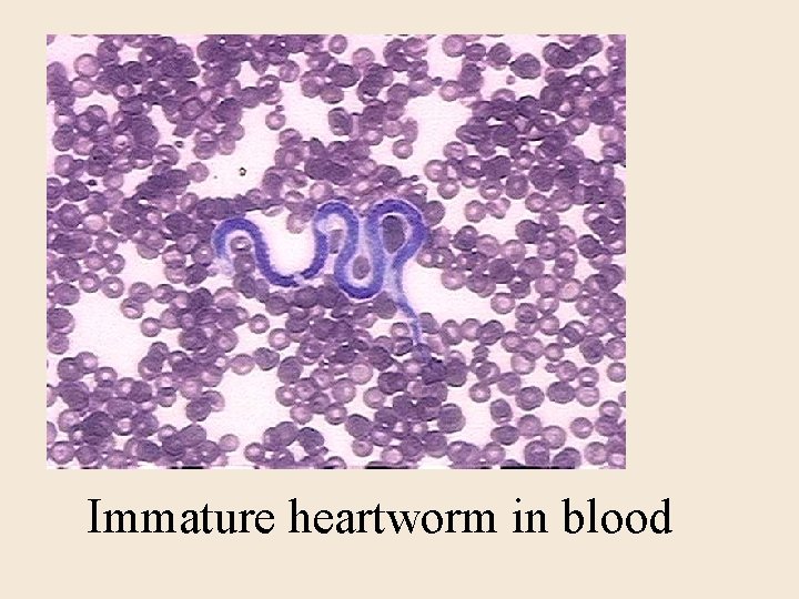 Immature heartworm in blood 