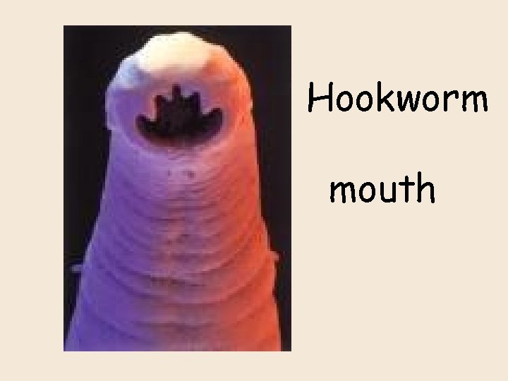 Hookworm mouth 