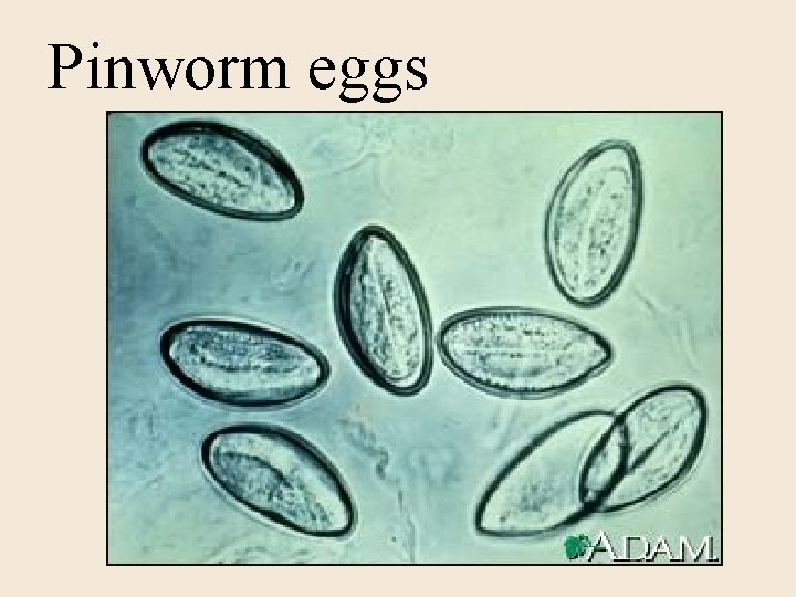 Pinworm eggs 