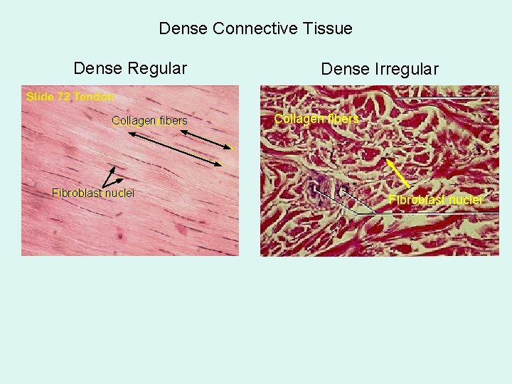 Dense Connective Tissue Dense Regular Collagen fibers Fibroblast nuclei Dense Irregular Collagen fibers Fibroblast