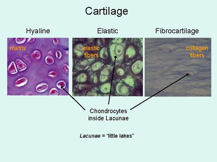 Cartilage Hyaline matrix Elastic elastic fibers Chondrocytes inside Lacunae = “little lakes” Fibrocartilage collagen