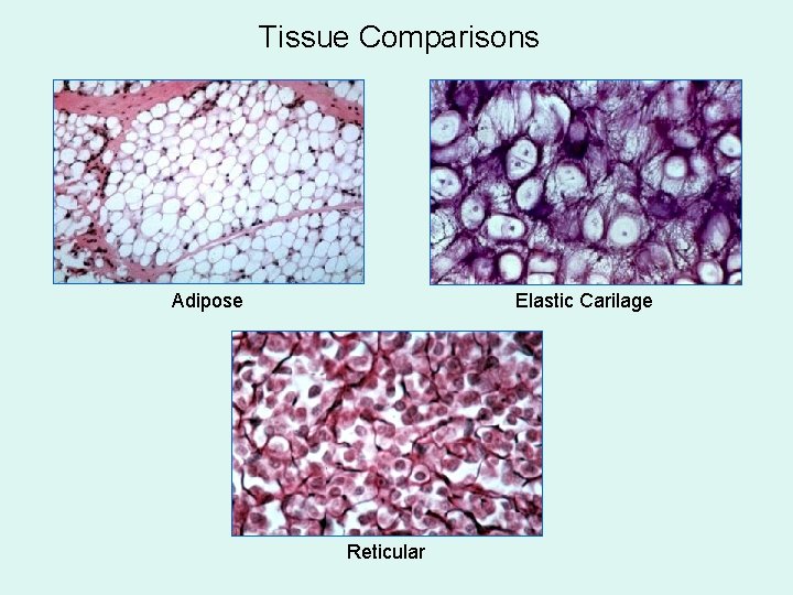 Tissue Comparisons Adipose Elastic Carilage Reticular 
