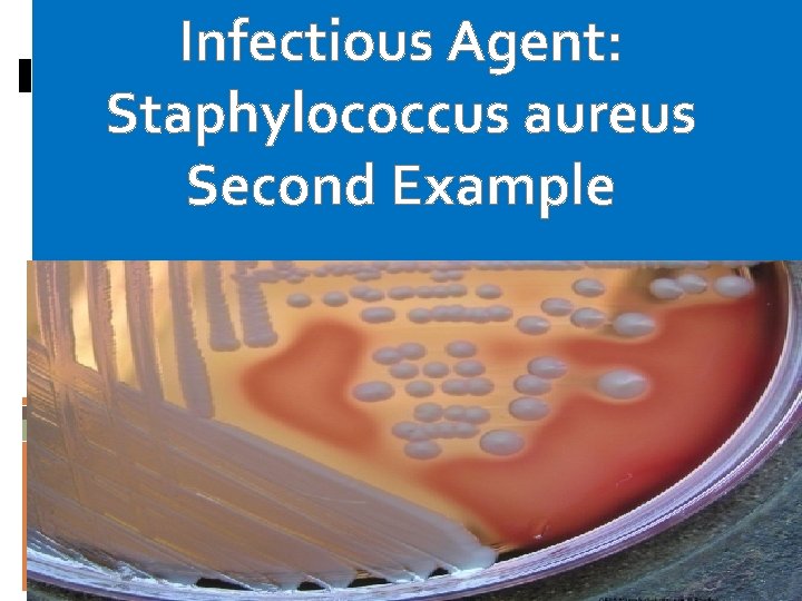 Infectious Agent: Staphylococcus aureus Second Example Infectious Agent: Staphylococcus aureus Second Example