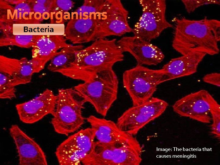 Microorganisms Bacteria Image: The bacteria that causes meningitis 