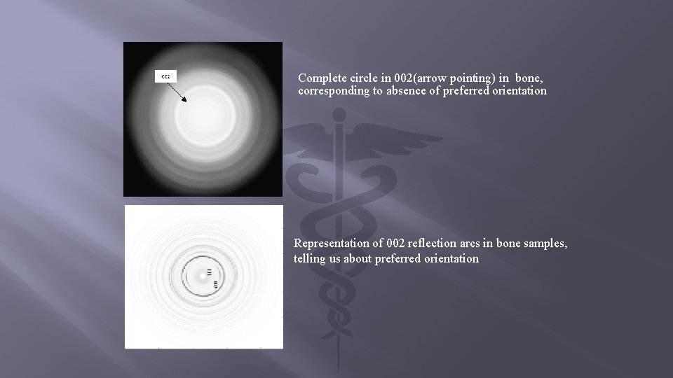 Complete circle in 002(arrow pointing) in bone, corresponding to absence of preferred orientation Representation
