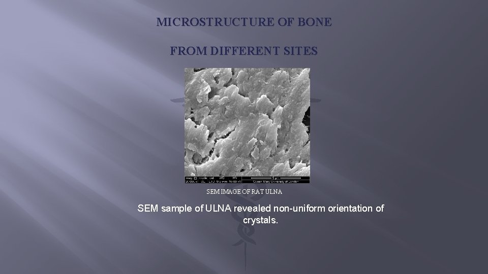 MICROSTRUCTURE OF BONE FROM DIFFERENT SITES SEM IMAGE OF RAT ULNA SEM sample of